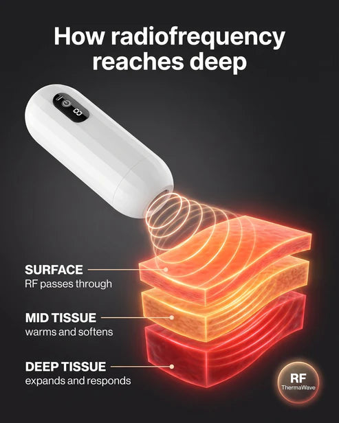 Radiofrequency depth illustration